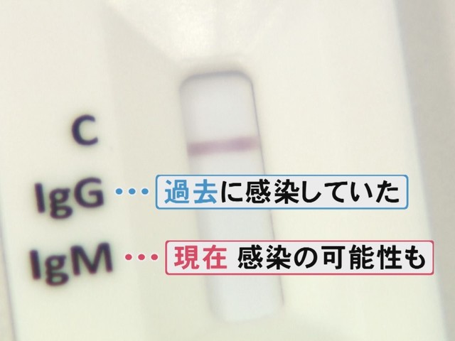 名古屋 コロナ 抗体 検査